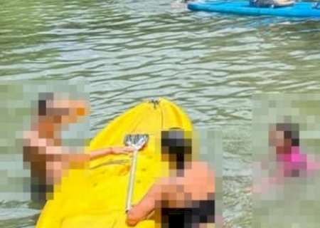 M&atilde;e denuncia balne&aacute;rio sem salva-vidas ap&oacute;s crian&ccedil;a quebrar perna