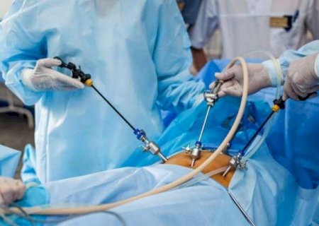 Cirurgias Bari&aacute;tricas em MS
