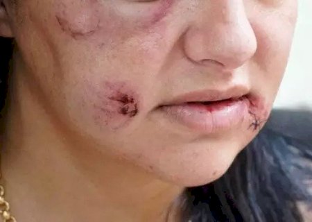 Sete em cada 10 pessoas conhece alguma mulher que j&aacute; foi agredida pelo parceiro