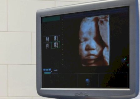 ‘Lei do batimento cardíaco’ impede mais de 23 mil abortos na Flórida