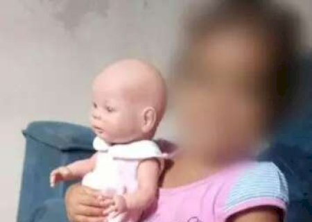 Morre beb&ecirc; que teve 90% do corpo queimado em explos&atilde;o de chapa