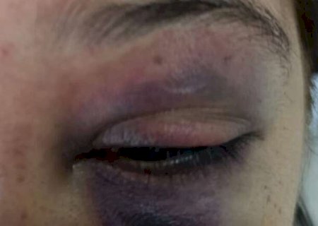 Mulher chega no trabalho com olho roxo, patr&atilde;o descobre agress&atilde;o e chama pol&iacute;cia