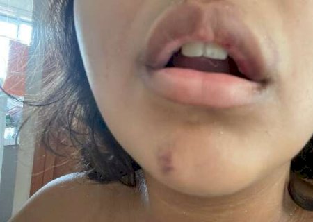 Ambulante diz ter sido agredida e blocos se defendem: &ldquo;agitadores"