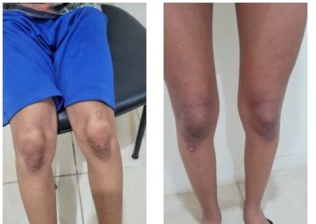 M&atilde;e e companheira s&atilde;o presas por tortura e maus-tratos de irm&atilde;os de 7 e 13 anos
