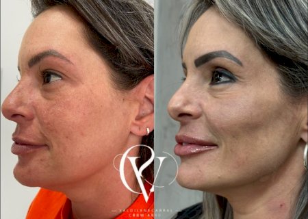 No m&ecirc;s da mulher, realce sua beleza com 50% de desconto nos tratamentos