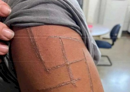 Estudante de medicina que torturou mulher trans é filho de Coronel